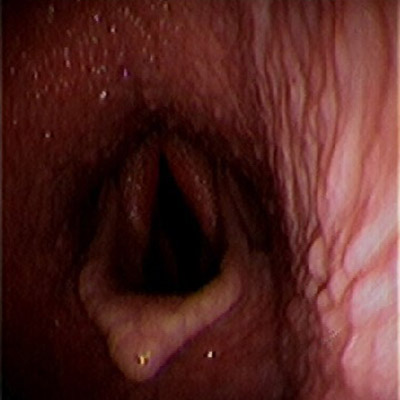 Endoscopy