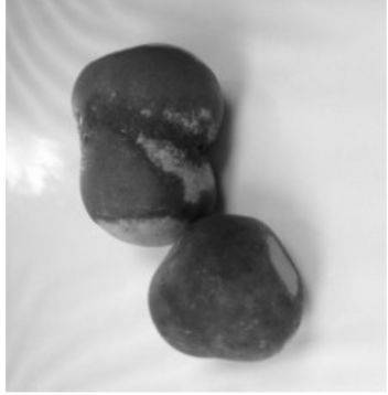 Enteroliths—one of which contains the horse shoe nail