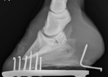 Nail in hoof