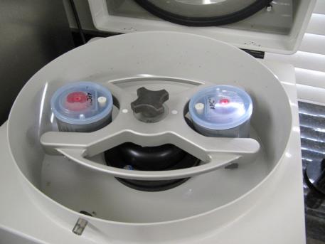 In order to treat a horse with Platelet Rich Plasma, the veterinarians at PBEC are able to take  a sample of the horse’s blood and concentrate the platelets in a high-speed centrifuge on-site. 